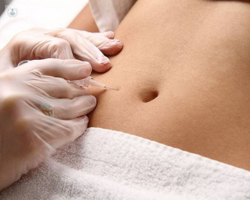 la-carboxiterapia-para-combatir-la-celulitis-el-exceso-de-grasa-y-envejecimiento-facial imagen de artículo