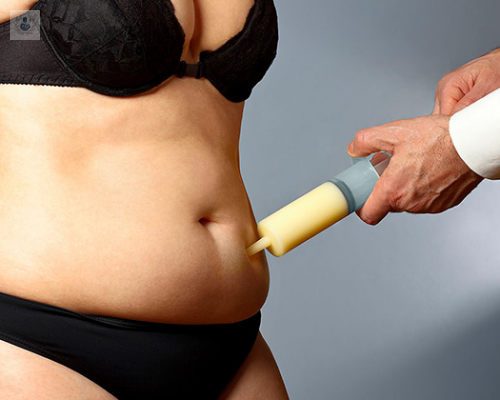 lipotransferencia-un-futuro-lleno-de-posibilidades imagen de artículo