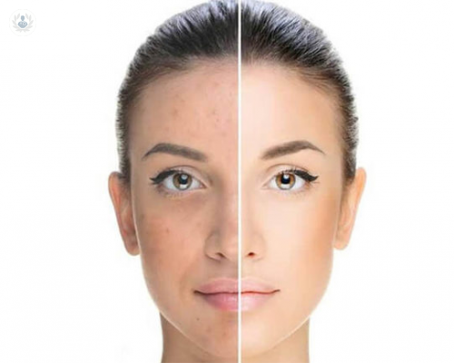 como-eliminar-manchas-y-lesiones-pigmentadas-en-la-piel imagen de artículo