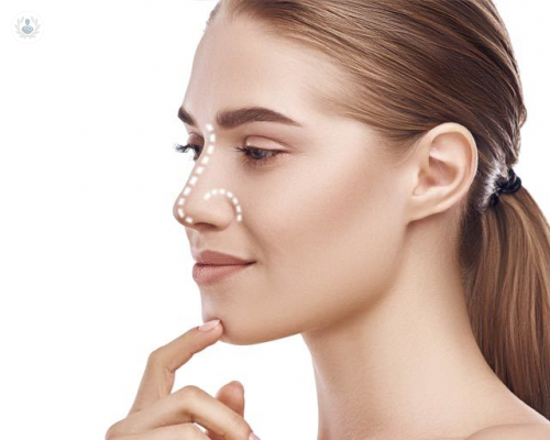 el-procedimiento-de-una-rinoplastia imagen de artículo