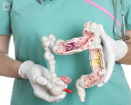 el-sindrome-del-intestino-irritable-o-colon-irritable imagen de artículo