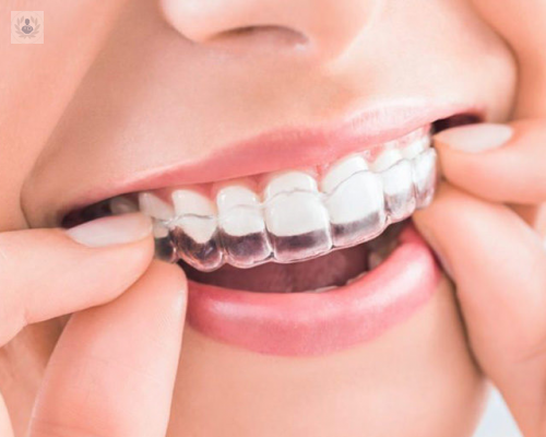 La Ortodoncia Invisible, definición y duración del tratamiento