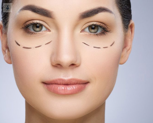 rejuvenece-con-la-blefaroplastia imagen de artículo