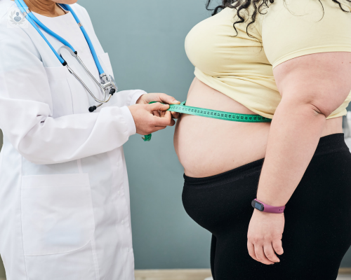 Tratamiento integral de la Obesidad