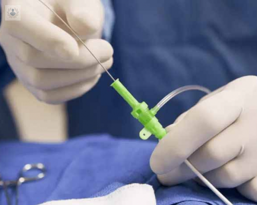 el-tratamiento-endovascular-exponente-de-la-innovacion-en-cirugia-vascular imagen de artículo