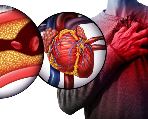 5-mitos-sobre-el-colesterol imagen de artículo