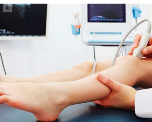 cirugia-laser-de-varices imagen de artículo