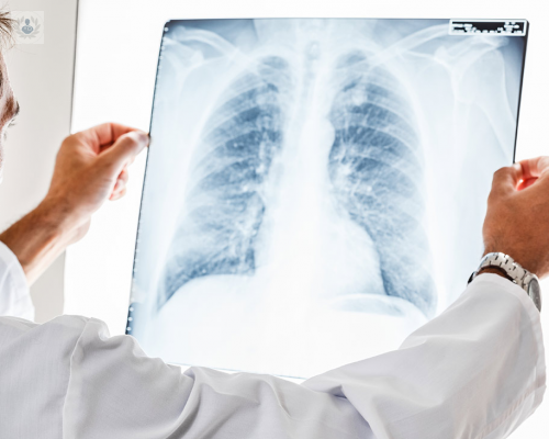 The pulmonary nodule diagnosis and its causes