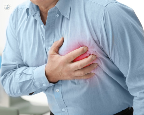 prevenir-los-problemas-cardiacos-durante-las-vacaciones imagen de artículo