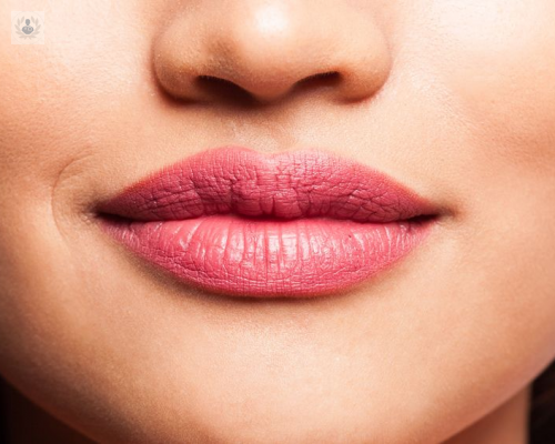 como-eliminar-las-arrugas-de-los-labios imagen de artículo