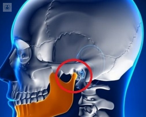 Tratamiento de la Articulación Temporomandibular