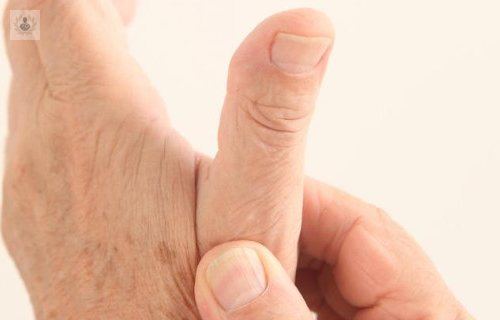 La Artrosis de la base del pulgar, un tratamiento a medida para cada paciente