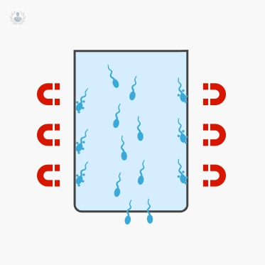 seleccion-espermatica-con-columnas-de-anexinas imagen de artículo