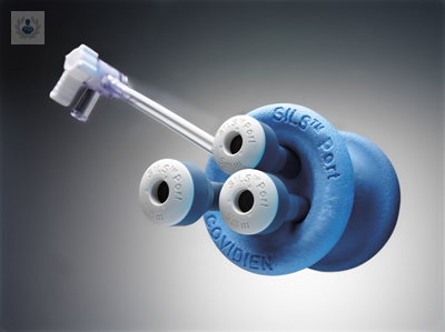 puerto-unico-nueva-tecnica-ginecologica-para-intervenir-con-una-incision-minima imagen de artículo