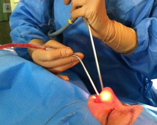 cirugia-endoscopica-nasal-operaciones-de-nariz-sin-incisiones-ni-complicaciones imagen de artículo