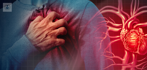 Cómo Prevenir un Infarto de Miocardio