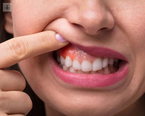 cirugia-periodontal imagen de artículo