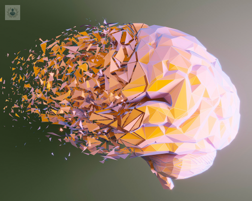 como-enlentecer-la-enfermedad-de-alzheimer imagen de artículo
