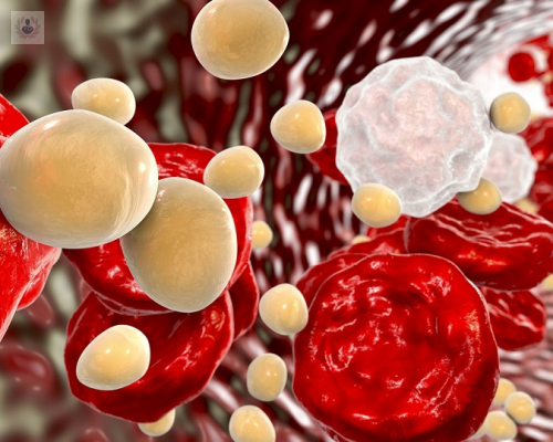 hipercolesterolemia imagen de artículo