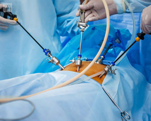 la-cirugia-laparoscopica-en-urologia imagen de artículo