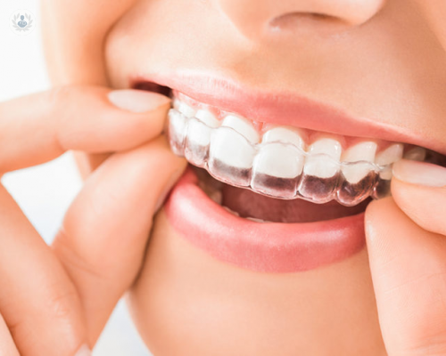 invisalign-una-alternativa-estetica-fiable-a-los-brackets imagen de artículo