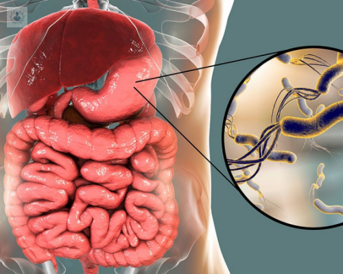 helicobacter-pylori imagen de artículo