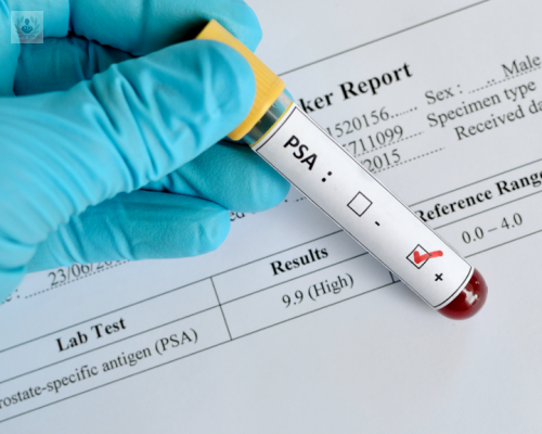 el-debate-sobre-el-psa-continua-las-ventajas-y-los-inconvenientes imagen de artículo