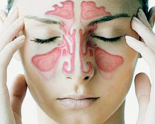 sinusitis-una-enfermedad-del-sistema-respiratorio imagen de artículo