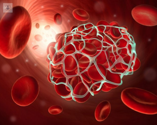 anticoagulantes-y-hematologia-de-la-fertilidad imagen de artículo