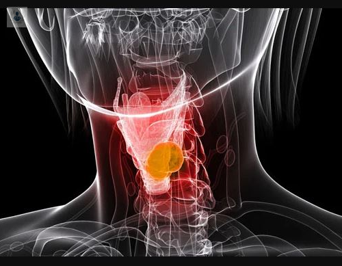 cancer-de-laringe-y-faringe imagen de artículo