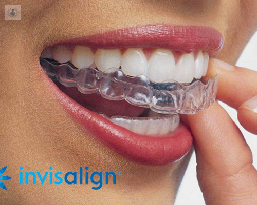 invisalign-la-ortodoncia-mas-estetica imagen de artículo