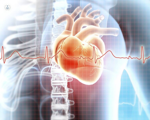 tratamiento-de-la-arritmia imagen de artículo