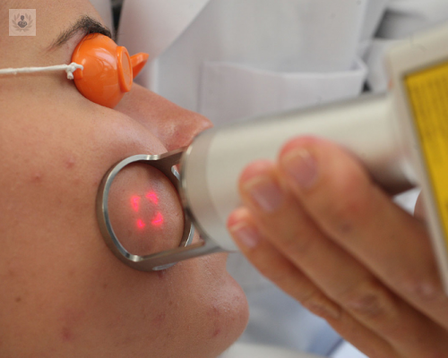 tratamiento-con-laser-de-las-lesiones-pigmentadas imagen de artículo