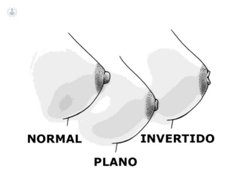 pezones-invertidos imagen de artículo