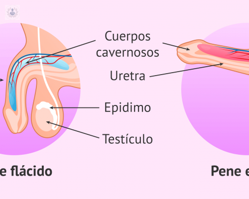 disfuncion-erectil-que-es-y-que-hay-detras-de-ella imagen de artículo