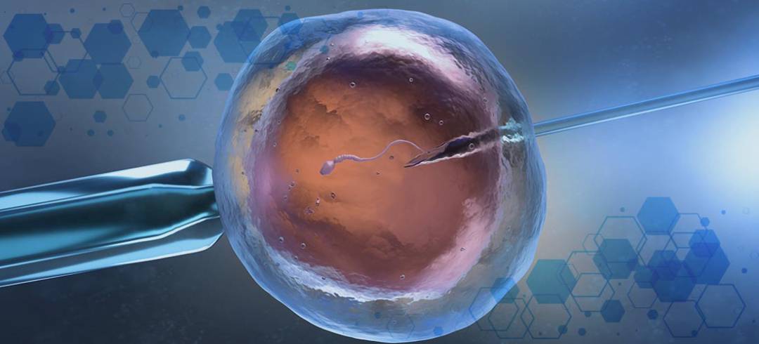 Técnicas de Fecundación In Vitro