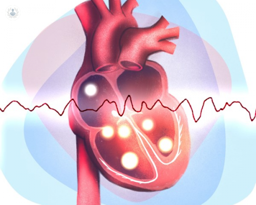 el-objetivo-en--el-tratamiento-de-las-arritmias-es-mejorar-la-calidad-de-vida-y-prolongarla imagen de artículo