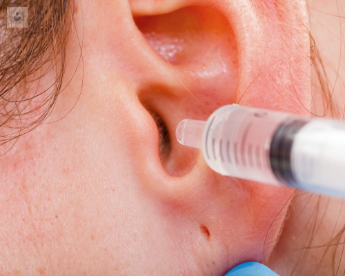 extraccion-de-los-tapones-de-cera imagen de artículo