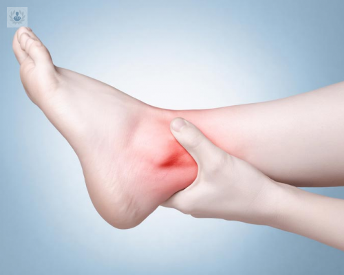 tendinitis-de-tobillo imagen de artículo