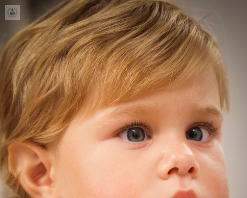 seudoestrabismo-y-tratamiento-del-estrabismo imagen de artículo