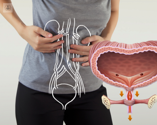 Tratamiento láser para la incontinencia urinaria en mujeres