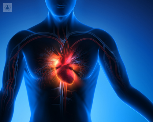 Terapia de resincronización cardíaca