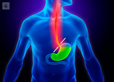 el-reflujo-gastroesofagico-causas-y-tratamiento imagen de artículo