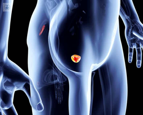 El láser prostático, la solución para la Hiperplasia Benigna de próstata