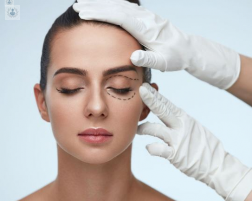 blefaroplastia-la-combinacion-de-estetica-y-salud imagen de artículo