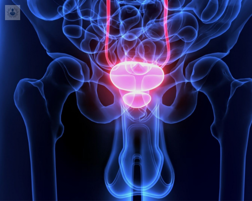 El cáncer de próstata: una patología sin síntomas