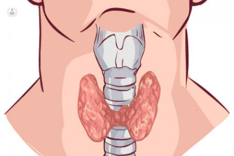cirugia-de-la-glandula-tiroides imagen de artículo