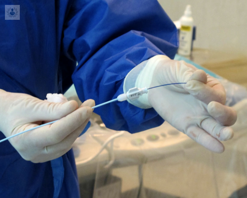 “El tratamiento endovascular es una técnica menos agresiva que una cirugía convencional”