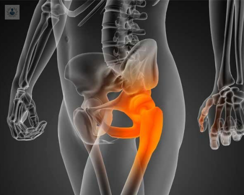 caderas-en-manos-expertas imagen de artículo