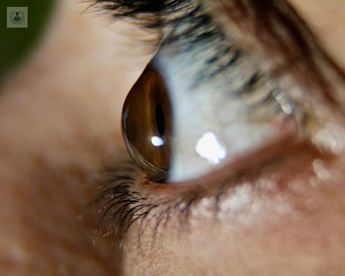 queratocono-una-enfermedad-degenerativa-de-la-cornea imagen de artículo